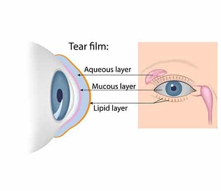 Dry eye treatment Los Angeles