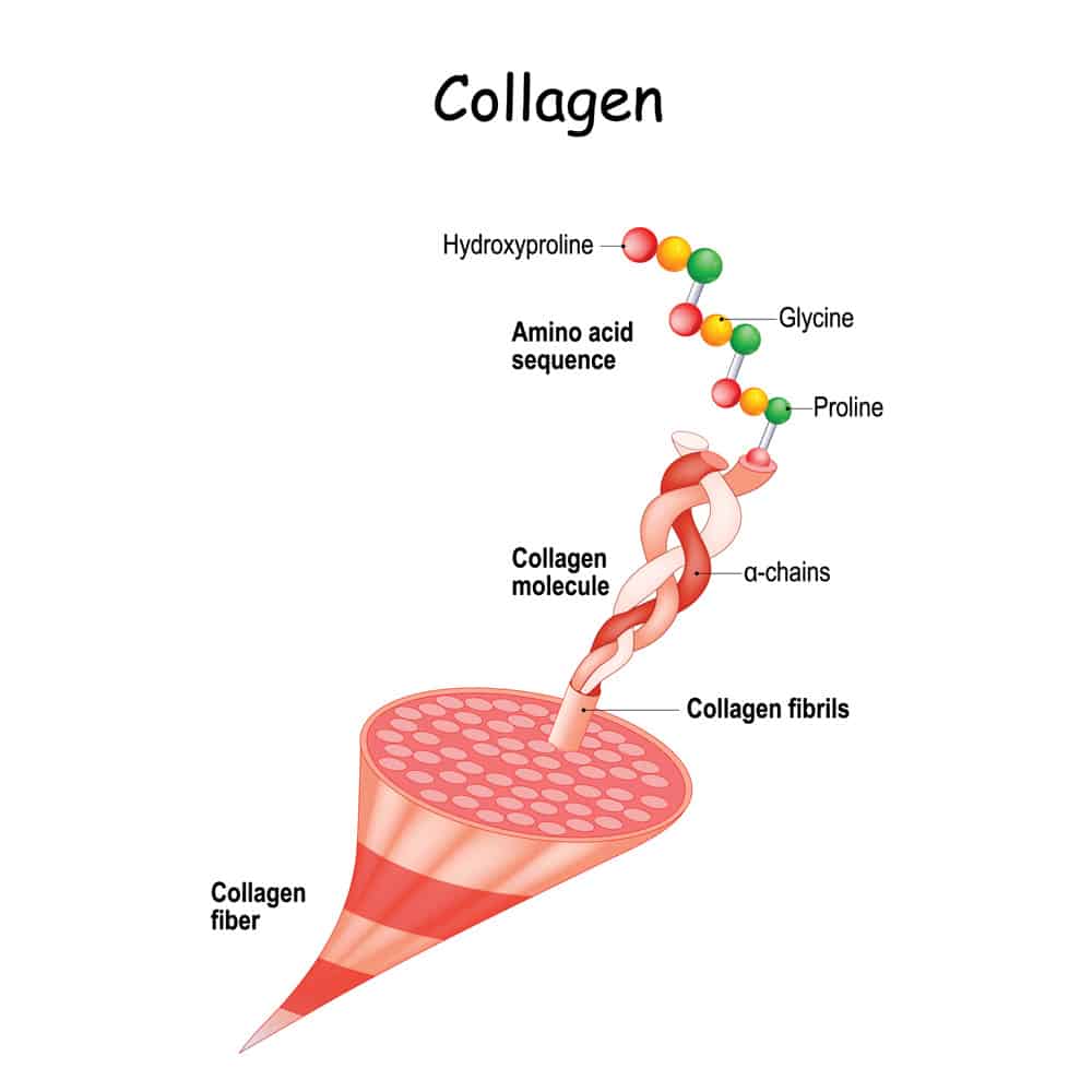 Corneal Cross-Linking 1 corneal cross-linking Los Angeles