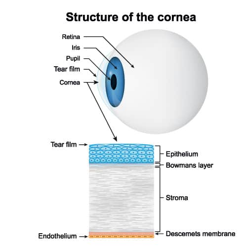 Corneal Cross-Linking 2 corneal collagen cross-linking Los Angeles